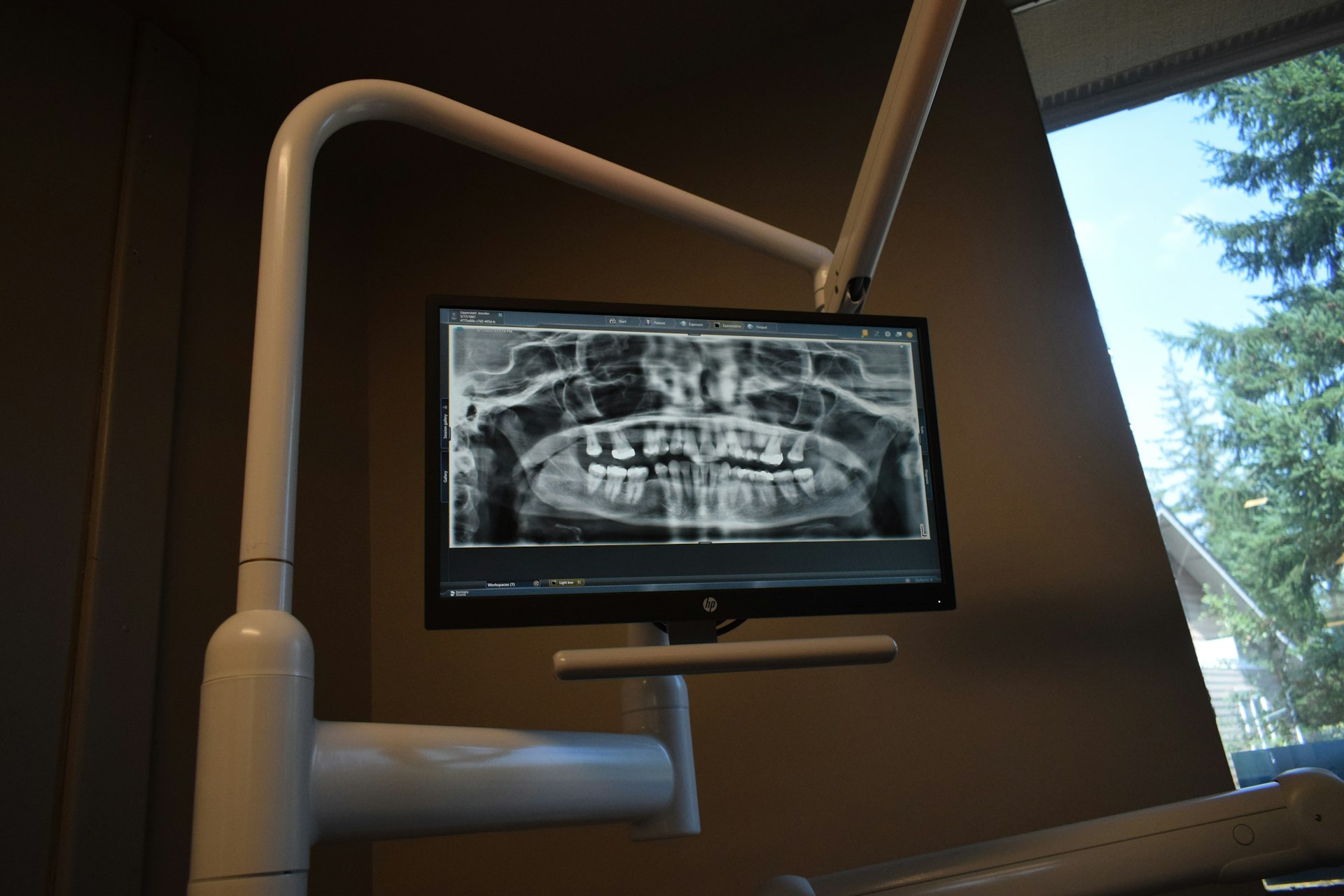Equipamento de Tomografia Cone Beam da Radiologia Orleans em Curitiba